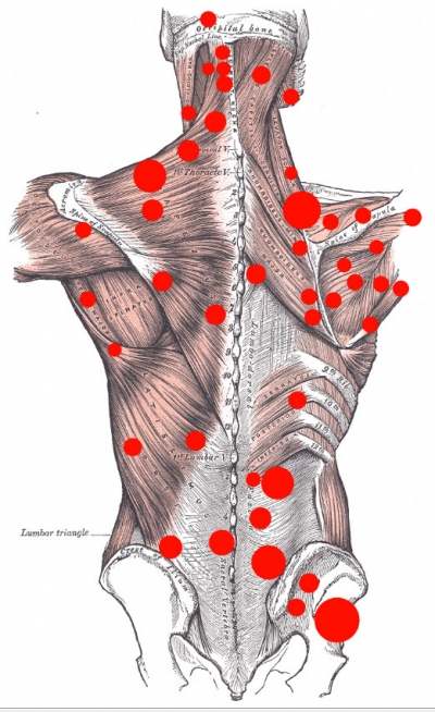 triggerpoint-map